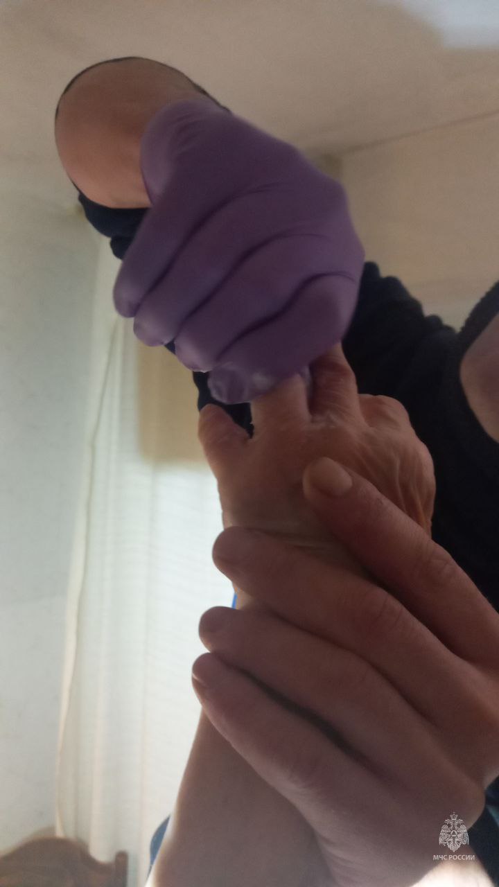 Магаданские спасатели дважды оказывали помощь в снятии колец с пальцев Магаданские спасатели дважды оказывали помощь в снятии колец с пальцев