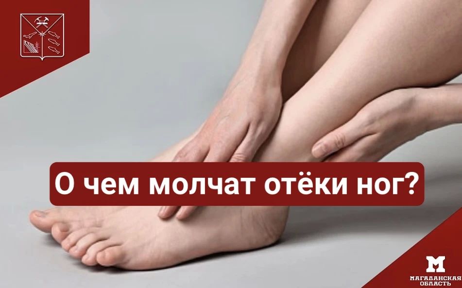 О чем молчат отёки ног?. Отёк — это не болезнь, а сигнал организма: где-то внутри что-то идёт не так